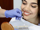 How Much Does Teeth Whitening Cost? - фото 1